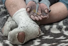 سيكولوجية الفقر